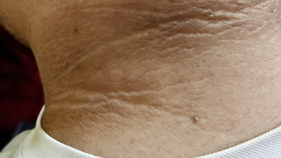 De nombreuses maladies dangereuses ne doivent pas être ignorées