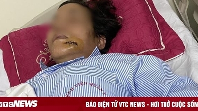 Nhắc nhở hàng xóm thả chó làm mất vệ sinh, người phụ nữ bị đánh nhập viện
