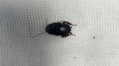 자다가 귀에서 바스락거리는 소리가 나서 병원에 가보니 바퀴벌레가 생겼어요