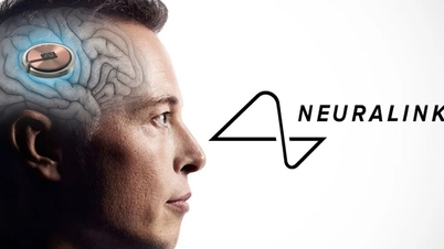 ប្រទេសកាណាដាអនុញ្ញាតឱ្យ Neuralink សាកល្បងការបញ្ចូលបន្ទះឈីបនៅក្នុងខួរក្បាលរបស់មនុស្ស
