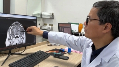 Nam thanh niên thoát nỗi ám ảnh 50-100 cơn động kinh mỗi ngày suốt 21 năm