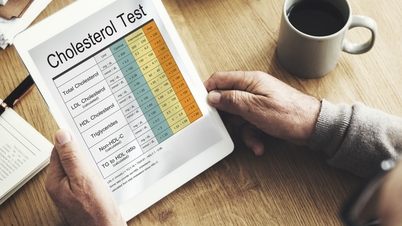 How sleep affects cholesterol