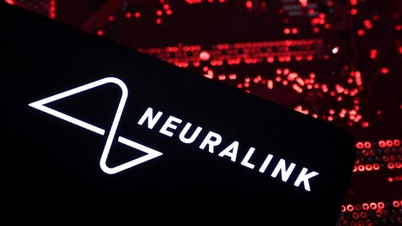 Neuralink cấy ghép chip não cho bệnh nhân thứ hai