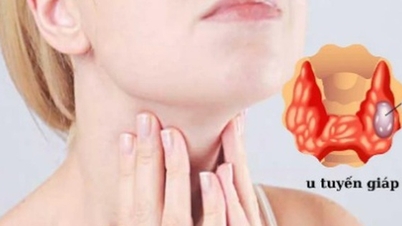 43-year-old woman with thyroid disease was advised by her doctor to do this regularly