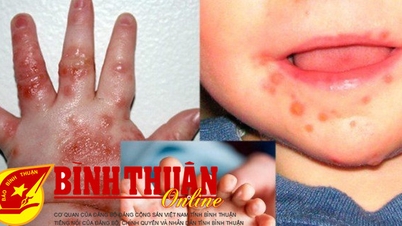 Nguy cơ gia tăng, phòng bệnh từ cộng đồng
