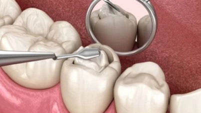 How long after tooth filling can I eat and drink normally?
