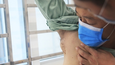 Sốt cao, nổi hạch do mèo cào