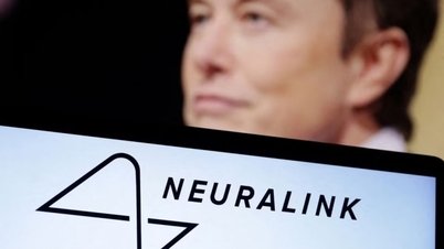Neuralink របស់ Elon Musk ទទួលបានការយល់ព្រមសម្រាប់ការផ្សាំខួរក្បាលរបស់មនុស្ស