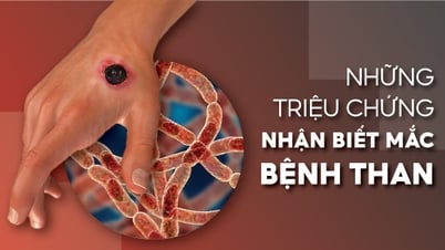 Những triệu chứng nhận biết mắc bệnh than