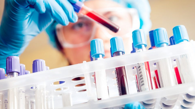 6 tests that require fasting before sampling
