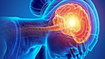 Girl with severe sinusitis had to have half her skull removed