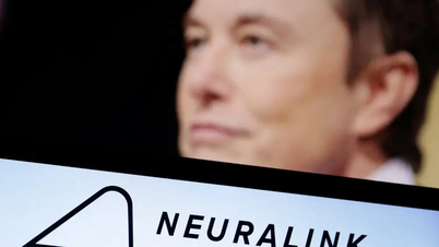 Neuralink របស់ Elon Musk ទទួលបានការយល់ព្រមសម្រាប់ការសាកល្បងមនុស្ស