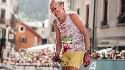 Runner về đích với gương mặt đầm đìa máu