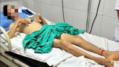 كاد رجل في باك جيانج أن يفقد حياته بعد شرب 10 لترات من الماء المؤين