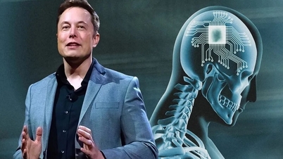 Công ty của Elon Musk được cấp phép cấy chip não ở người
