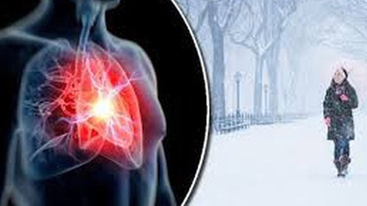 Ne faites pas ces choses si vous ne voulez pas avoir un accident vasculaire cérébral.
