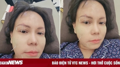 តារា​ល្បី​ៗ​របស់​វៀតណាម​ជា​អកុសល​មាន​មុខ​ពាក់កណ្តាល​ពិការ ហើយ​ខ្លះ​ប្រឈម​នឹង​ជំងឺ​ដាច់​សរសៃឈាម​ខួរក្បាល