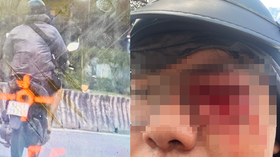 交通警察の警棒で目を負傷したと「告発」された若い男性の事件に関する新たな詳細