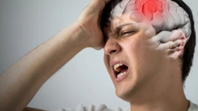 43% ca đột quỵ có dấu hiệu này trước 1 tuần