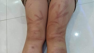 Piden aclarar responsabilidad en caso de 6 estudiantes de preescolar golpeados y contusionados