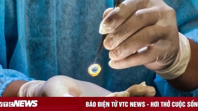 Cụ ông 86 tuổi là người hiến tặng giác mạc đầu tiên ở Hoà Bình