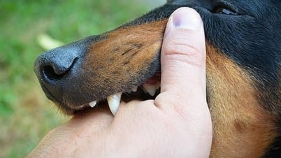 Một phụ nữ lên cơn dại và tử vong sau 3 tháng bị chó nhà cắn