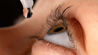 Cô gái Mỹ nhỏ nhầm keo siêu dính thay vì thuốc nhỏ mắt