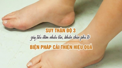 Suy thận độ 3 gây tiểu đêm nhiều lần, chân phù to – Cách hỗ trợ nào hiệu quả?