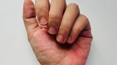 Có phải chỉ là thói quen xấu?