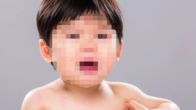 子供の牛乳タンパク質アレルギーは危険ですか？