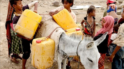 Trẻ em Yemen suy dinh dưỡng trầm trọng