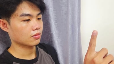 Doctor shows simple exercises to help keep eyes healthy