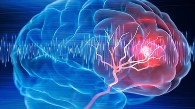 Một trong những thực phẩm tốt nhất giúp giảm huyết áp cao và đột quỵ