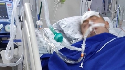 Man with sore throat had most of his stomach removed due to this mistake when taking medicine