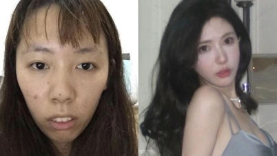 Hot girl Trung Quốc phẫn nộ khi bị tung ảnh thời còn xấu xí, chưa dao kéo