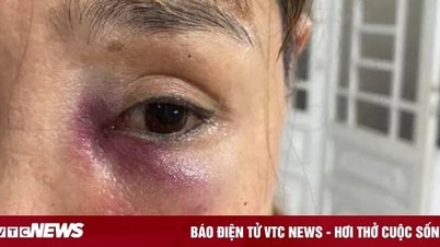 Female owner of Quang noodle shop was beaten by male customer, leaving her face bruised