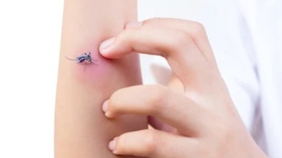 Why are some people often bitten by mosquitoes, while others are 'disliked' by mosquitoes?