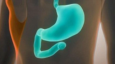 ផលវិបាកនៃជំងឺទឹកនោមផ្អែម gastroparesis ងាយនឹងខកខានក្នុងពេលធ្វើរោគវិនិច្ឆ័យ។