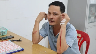 Điều dưỡng bị người nhà bệnh nhân hành hung dã man tại bệnh viện