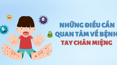 Những điều cần quan tâm về bệnh tay chân miệng