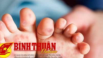 Giám sát nguyên nhân bệnh nhi tử vong nghi do bệnh tay chân miệng ở La Gi