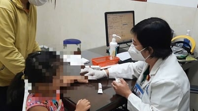 Cảnh báo lây lan bệnh chốc trong mùa tựu trường