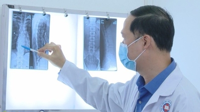 Gãy xương sườn sau khi đi bẻ khớp tại nhà thầy lang