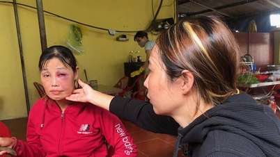 Ba Ria - Vung Tau: Investigation into the case of a Quang noodle seller being beaten by a customer, causing his face to swell