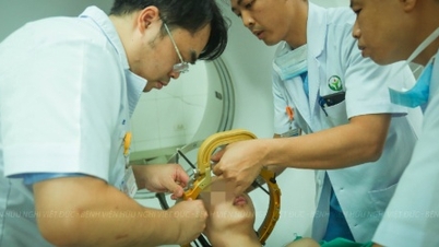 신경 운동 장애가 있는 환자를 위한 기회