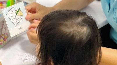 Chấp nhận con là 'em bé đặc biệt'