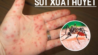 Dịch sốt xuất huyết đang tăng cao, tỉ lệ tử vong như thế nào