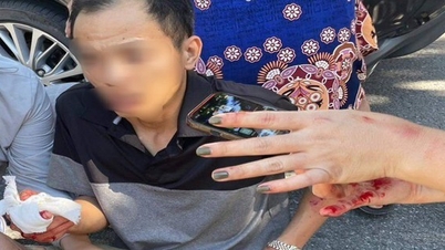 Điều tra vụ chém người giữa phố, nghi do mâu thuẫn làm ăn