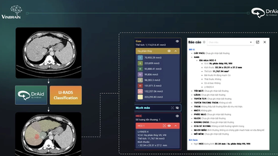 VinBrain cooperates with Central Lung Hospital to deploy AI software in tuberculosis screening