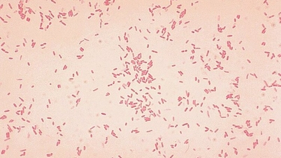Flesh-eating bacteria attack old man